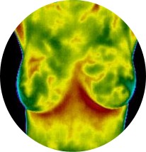 thermogrphie_des_seins